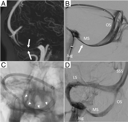 FIG 3.