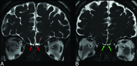 FIG 9.