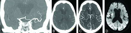 FIG 5.