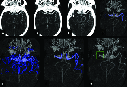 FIG 4.