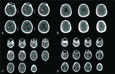 FIG 1.