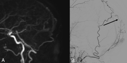FIG 3.