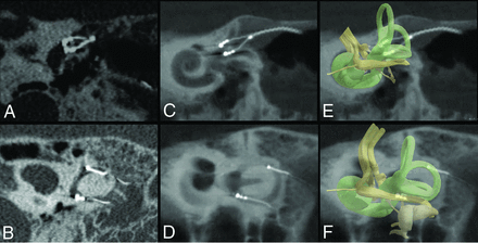 FIG 2.