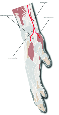 FIG 5.