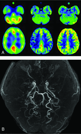 FIG 4.