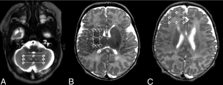 FIG 1.