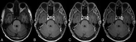FIG 3.