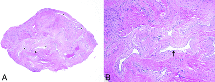 FIG 4.