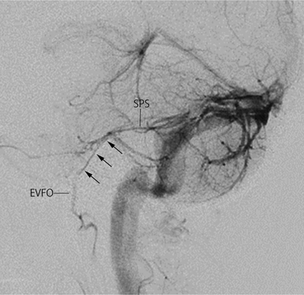 FIG 2.