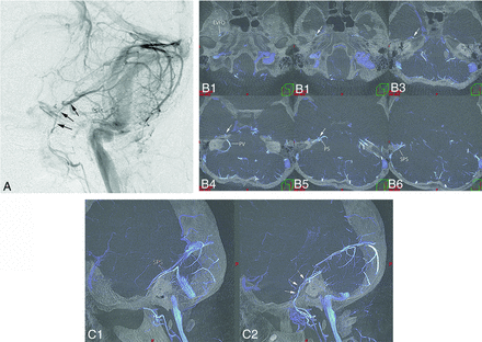 FIG 4.