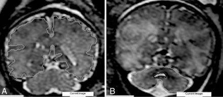 FIG 1.