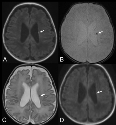 FIG 2.