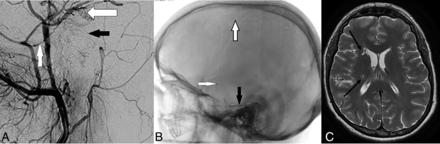 FIG 2.