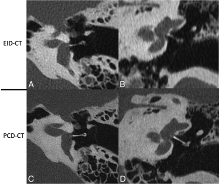 FIG 5.