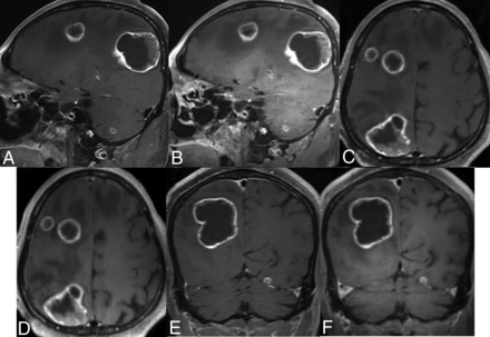 FIG 4.