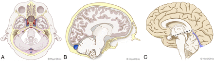 FIG 3.