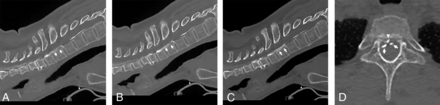FIG 3.