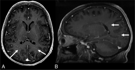 FIG 5.