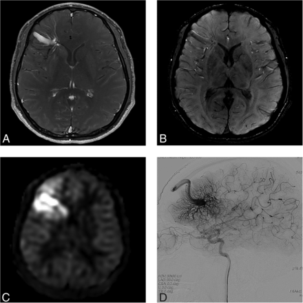 FIG 1.