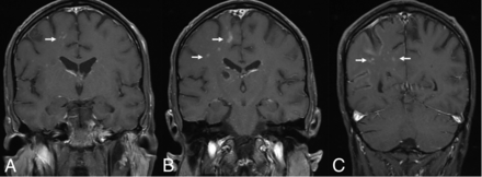 FIG 4.