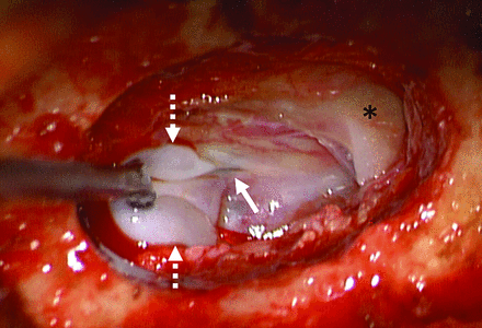 FIG 2.