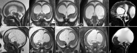 FIG 3.