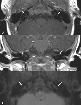 FIG 1.