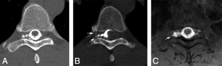 FIG 4.