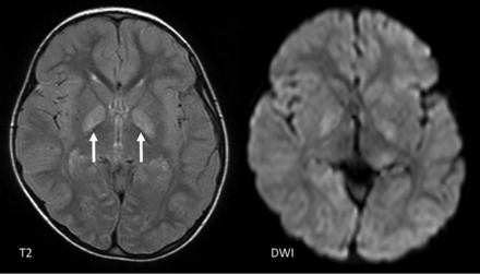 FIG 11.