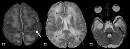 FIG 12.