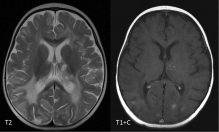 FIG 13.