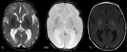 FIG 2.