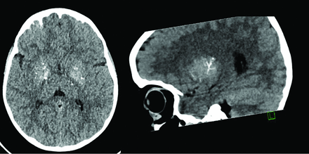 FIG 6.
