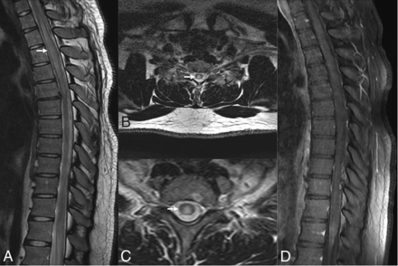 FIG 2.