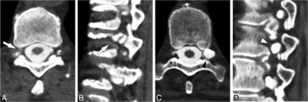 FIG 3.