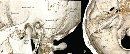 FIG 2.