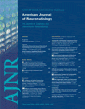 American Journal of Neuroradiology: 30 (suppl 1)