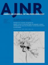 American Journal of Neuroradiology: 43 (1)